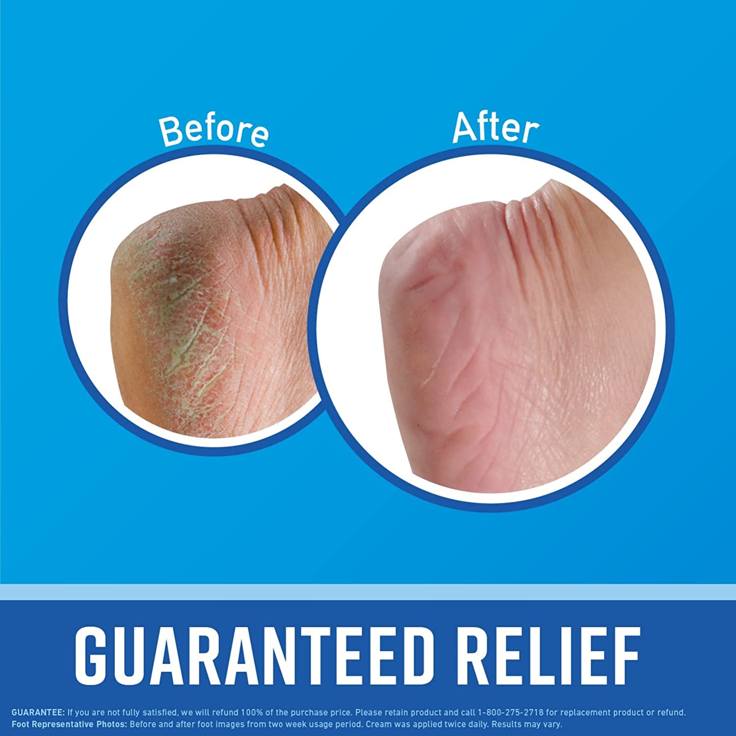 O'Keeffe's Healthy Feet Foot Cream - Ultimate Relief for Dry, Cracked Feet - Instant Moisture Boost - 3.2 oz Jar (Pack of 3)